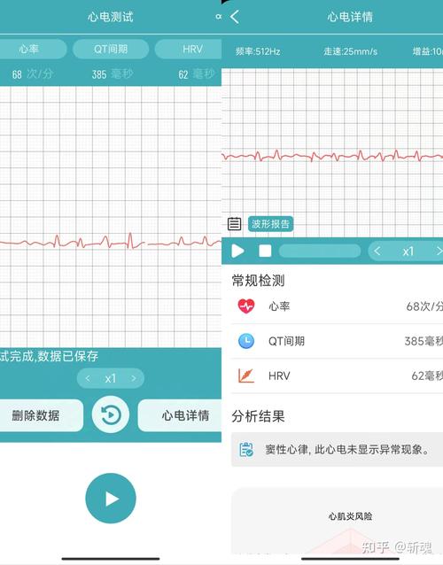 父母做运动声音太大可以提醒吗？试试智能运动提醒器